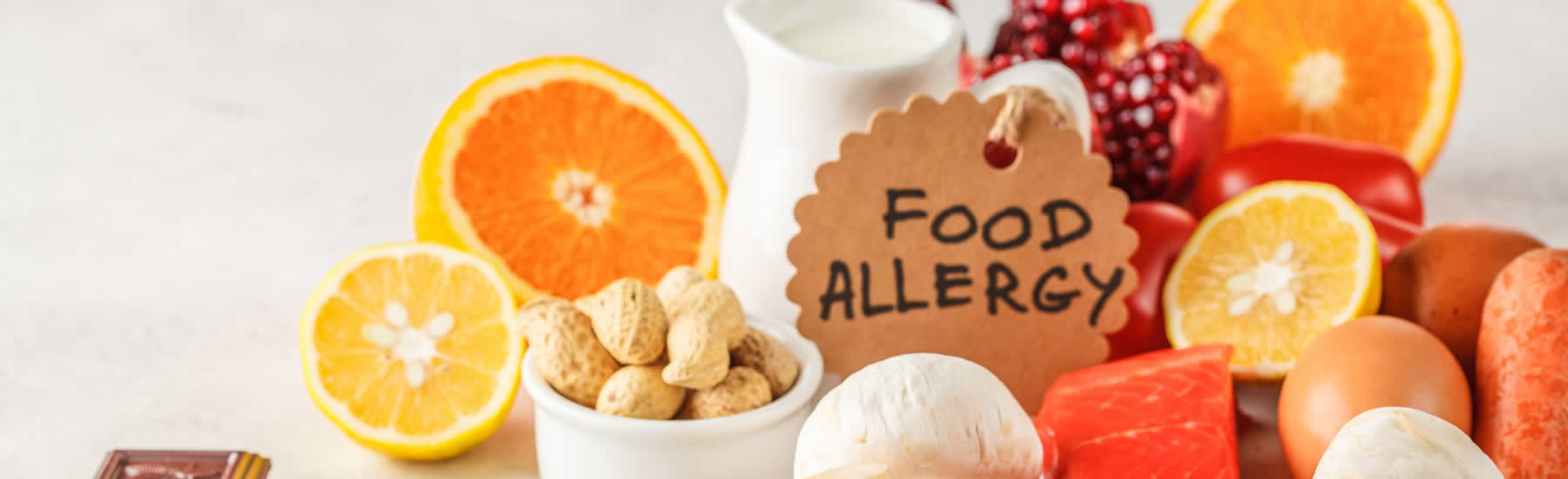 Let Disease Management and Prevention Dietitians of Fargo help you with your food allergies.